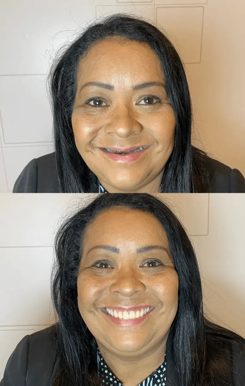 Sorriso transformado de paciente da Oral Brasil