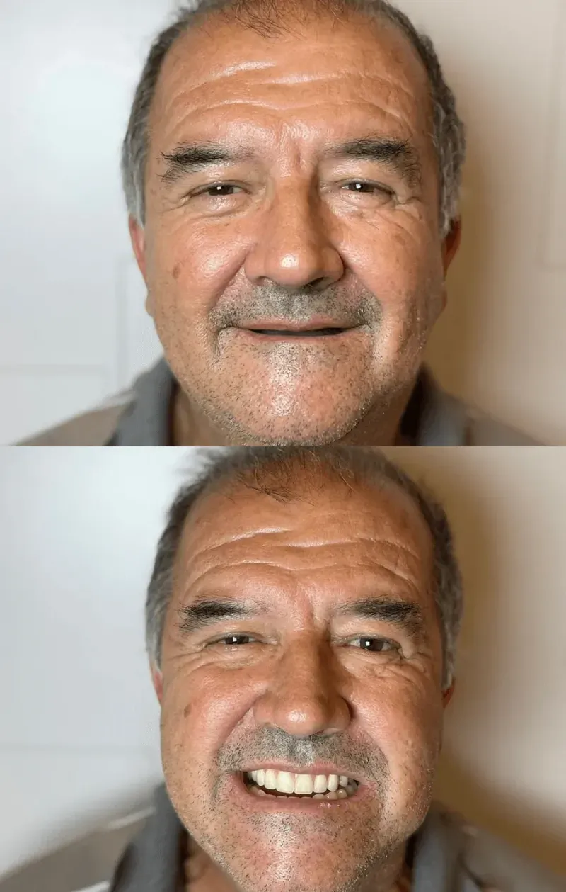Sorriso transformado de paciente da Oral Brasil