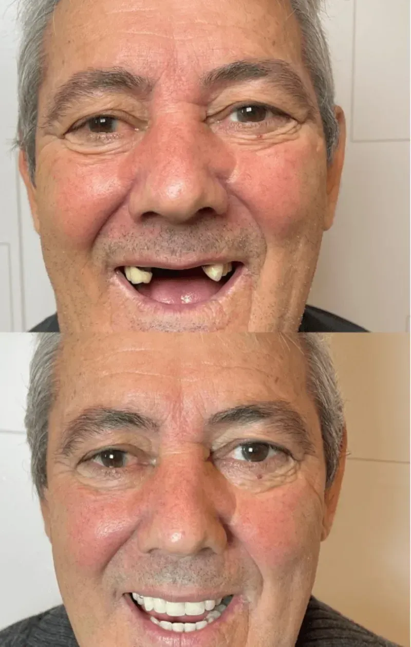 Sorriso transformado de paciente da Oral Brasil