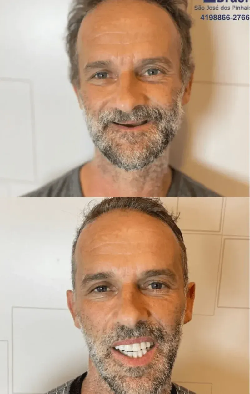 Sorriso transformado de paciente da Oral Brasil