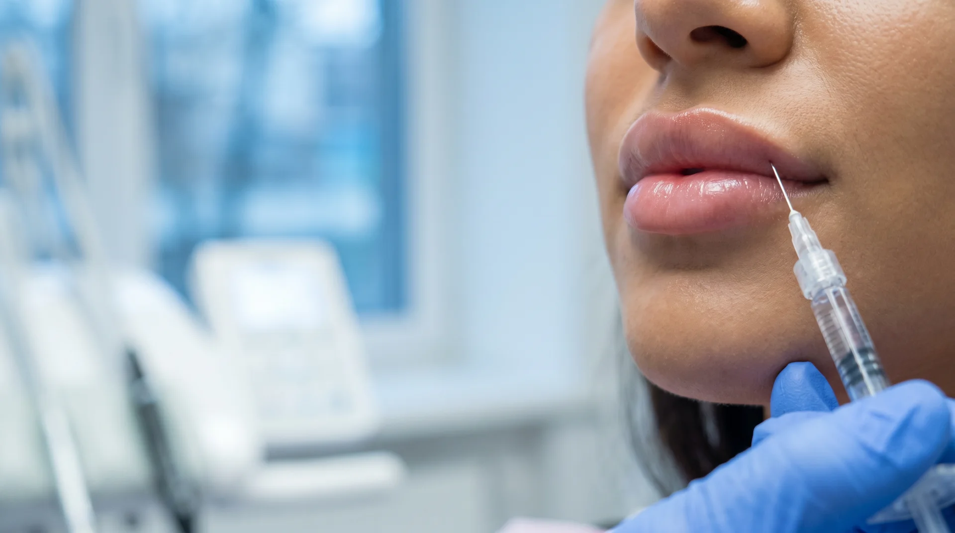Aplicação de preenchimento labial com ácido hialurônico em close nos lábios, na Oral Brasil